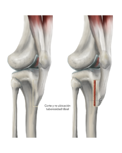 CIENHOJAS TALLERES ANATOMÍA