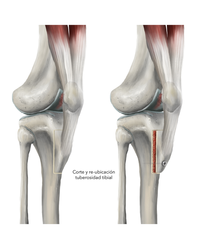 CIENHOJAS TALLERES ANATOMÍA